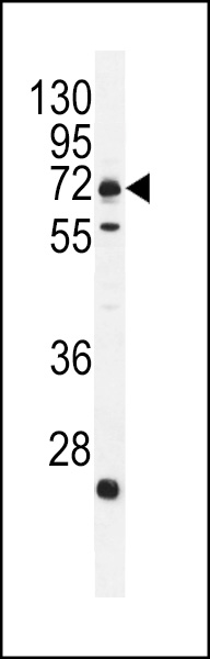 MIC1 Antibody (N-term) (Cat. #AP11766a) western blot analysis in MDA-MB231 cell line lysates (35ug/lane).This demonstrates the MIC1 antibody detected the MIC1 protein (arrow).
