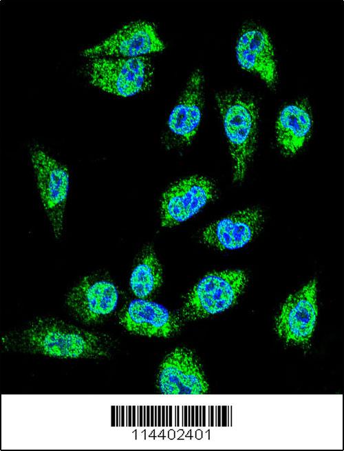 Confocal immunofluorescent analysis of MIC1 Antibody (N-term)(Cat#AP11766a) with MDA-MBA231 cell followed by Alexa Fluor 488-conjugated goat anti-rabbit lgG (green). DAPI was used to stain the cell nuclear (blue).