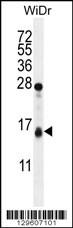 TOMM20L Antibody (N-term) (Cat. #AP11737a) western blot analysis in WiDr cell line lysates (35ug/lane).This demonstrates the TOMM20L antibody detected the TOMM20L protein (arrow).