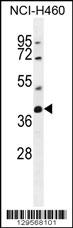 SRD5A2L2 Antibody (C-term) (Cat. #AP11735b) western blot analysis in NCI-H460 cell line lysates (35ug/lane).This demonstrates the SRD5A2L2 antibody detected the SRD5A2L2 protein (arrow).