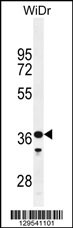 GLT8D3 Antibody (C-term) (Cat. #AP11732b) western blot analysis in WiDr cell line lysates (35ug/lane).This demonstrates the GLT8D3 antibody detected the GLT8D3 protein (arrow).