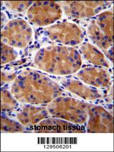 GIN1 Antibody (C-term) (Cat. #AP11728b)immunohistochemistry analysis in formalin fixed and paraffin embedded human stomach tissue followed by peroxidase conjugation of the secondary antibody and DAB staining.This data demonstrates the use of GIN1 Antibody (C-term) for immunohistochemistry. Clinical relevance has not been evaluated.