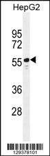 TTC6 Antibody (C-term) (Cat. #AP11724b) western blot analysis in HepG2 cell line lysates (35ug/lane).This demonstrates the TTC6 antibody detected the TTC6 protein (arrow).