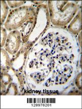 BRUNOL6 Antibody (N-term) (Cat. #AP11714a)immunohistochemistry analysis in formalin fixed and paraffin embedded human kidney tissue followed by peroxidase conjugation of the secondary antibody and DAB staining.This data demonstrates the use of BRUNOL6 Antibody (N-term) for immunohistochemistry. Clinical relevance has not been evaluated.