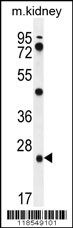 PGPEP1 Antibody (N-term) (Cat. #AP11685a) western blot analysis in mouse kidney tissue lysates (35ug/lane).This demonstrates the PGPEP1 antibody detected the PGPEP1 protein (arrow).