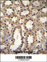 GPC6 Antibody (C-term) (Cat. #AP11674b)immunohistochemistry analysis in formalin fixed and paraffin embedded human kidney tissue followed by peroxidase conjugation of the secondary antibody and DAB staining.This data demonstrates the use of GPC6 Antibody (C-term) for immunohistochemistry. Clinical relevance has not been evaluated.