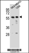 FOXD4 Antibody (Center) (Cat. #AP12181c) western blot analysis in MDA-MB453,CEM cell line lysates (35ug/lane).This demonstrates the FOXD4 antibody detected the FOXD4 protein (arrow).