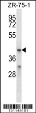 MFSD2B Antibody (C-term) (Cat. #AP14483b) western blot analysis in ZR-75-1 cell line lysates (35ug/lane).This demonstrates the MFSD2B antibody detected the MFSD2B protein (arrow).