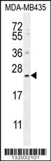 FAM109A Antibody (N-term) (Cat. #AP12167a) western blot analysis in MDA-MB435 cell line lysates (35ug/lane).This demonstrates the FAM109A antibody detected the FAM109A protein (arrow).