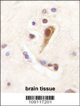 Formalin-fixed and paraffin-embedded human brain tissue reacted with Lhx6 Antibody (N-term) (Cat.#AP1423a), which was peroxidase-conjugated to the secondary antibody, followed by DAB staining. This data demonstrates the use of this antibody for immunohistochemistry; clinical relevance has not been evaluated.
