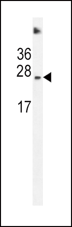 SDHD Antibody (N-term) (Cat. #AP12155a) western blot analysis in Hela cell line lysates (35ug/lane).This demonstrates the SDHD antibody detected the SDHD protein (arrow).