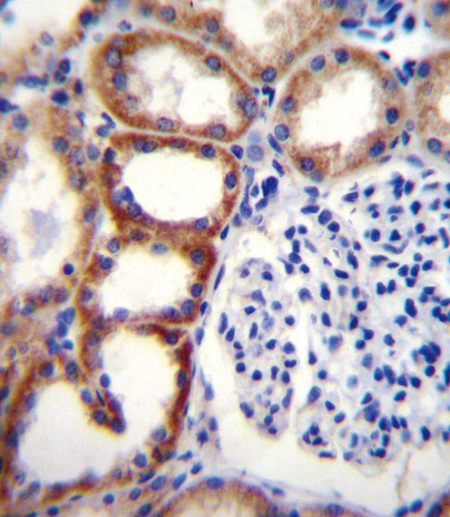 SDHD Antibody (N-term) (Cat. #AP12155a)immunohistochemistry analysis in formalin fixed and paraffin embedded human kidney tissue followed by peroxidase conjugation of the secondary antibody and DAB staining.This data demonstrates the use of SDHD Antibody (N-term) for immunohistochemistry. Clinical relevance has not been evaluated.