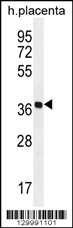OR5AS1 Antibody (C-term) (Cat. #AP12135b) western blot analysis in human placenta tissue lysates (35ug/lane).This demonstrates the OR5AS1 antibody detected the OR5AS1 protein (arrow).