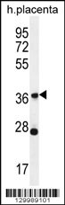 OR4L1 Antibody (C-term) (Cat. #AP12134b) western blot analysis in human placenta tissue lysates (35ug/lane).This demonstrates the OR4L1 antibody detected the OR4L1 protein (arrow).