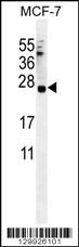 C20orf201 Antibody (C-term) (Cat. #AP12128b) western blot analysis in MCF-7 cell line lysates (35ug/lane).This demonstrates the C20orf201 antibody detected the C20orf201 protein (arrow).