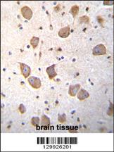 C20orf201 Antibody (C-term) (Cat. #AP12128b)immunohistochemistry analysis in formalin fixed and paraffin embedded human brain tissue followed by peroxidase conjugation of the secondary antibody and DAB staining.This data demonstrates the use of C20orf201 Antibody (C-term) for immunohistochemistry. Clinical relevance has not been evaluated.