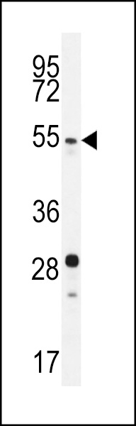 SUV4-20H2 Antibody (N-term) (Cat. #AP12073a) western blot analysis in mouse stomach tissue lysates (35ug/lane).This demonstrates the SUV4-20H2 antibody detected the SUV4-20H2 protein (arrow).