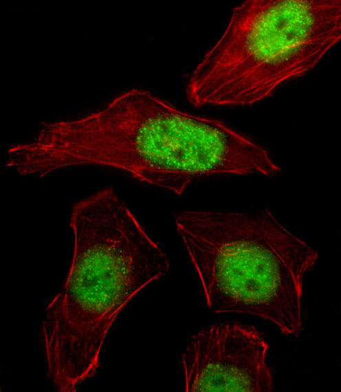 Fluorescent image of A549 cell stained with PURB Antibody (C-term)(Cat#AP12051b).A549 cells were fixed with 4% PFA (20 min), permeabilized with Triton X-100 (0.1%, 10 min), then incubated with PURB primary antibody (1:25, 1 h at 37℃). For secondary antibody, Alexa Fluor® 488 conjugated donkey anti-rabbit antibody (green) was used (1:400, 50 min at 37℃).Cytoplasmic actin was counterstained with Alexa Fluor® 555 (red) conjugated Phalloidin (7units/ml, 1 h at 37℃).PURB immunoreactivity is localized to Nucleus significantly. 