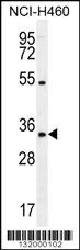 PURB Antibody (C-term) (Cat. #AP12051b) western blot analysis in NCI-H460 cell line lysates (35ug/lane).This demonstrates the PURB antibody detected the PURB protein (arrow).