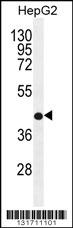 RDH13 Antibody (Center) (Cat. #AP12029c) western blot analysis in HepG2 cell line lysates (35ug/lane).This demonstrates the RDH13 antibody detected the RDH13 protein (arrow).