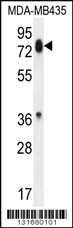 PCDHB13 Antibody (Center) (Cat. #AP12020c) western blot analysis in MDA-MB435 cell line lysates (35ug/lane).This demonstrates the PCDHB13 antibody detected the PCDHB13 protein (arrow).