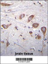 PLCL2 Antibody (C-term) (Cat. #AP12004b)immunohistochemistry analysis in formalin fixed and paraffin embedded human brain tissue followed by peroxidase conjugation of the secondary antibody and DAB staining.This data demonstrates the use of PLCL2 Antibody (C-term) for immunohistochemistry. Clinical relevance has not been evaluated.