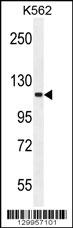 FUSSEL18 Antibody (C-term) (Cat. #AP11997b) western blot analysis in K562 cell line lysates (35ug/lane).This demonstrates the FUSSEL18 antibody detected the FUSSEL18 protein (arrow).
