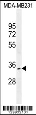 OTUD6A Antibody (Center) (Cat. #AP11994c) western blot analysis in MDA-MB231 cell line lysates (35ug/lane).This demonstrates the OTUD6A antibody detected the OTUD6A protein (arrow).