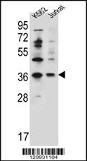 PPP1R3G Antibody (C-term) (Cat. #AP11993b) western blot analysis in K562,Jurkat cell line lysates (35ug/lane).This demonstrates the PPP1R3G antibody detected the PPP1R3G protein (arrow).