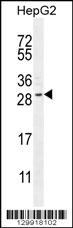 CCDC153 Antibody (N-term) (Cat. #AP11991a) western blot analysis in HepG2 cell line lysates (35ug/lane).This demonstrates the CCDC153 antibody detected the CCDC153 protein (arrow).