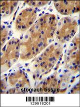 CCDC153 Antibody (N-term) (Cat. #AP11991a)immunohistochemistry analysis in formalin fixed and paraffin embedded human stomach tissue followed by peroxidase conjugation of the secondary antibody and DAB staining.This data demonstrates the use of CCDC153 Antibody (N-term) for immunohistochemistry. Clinical relevance has not been evaluated.