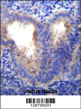 EIF5AL1 Antibody (C-term) (Cat. #AP11986b)immunohistochemistry analysis in formalin fixed and paraffin embedded human uterus tissue followed by peroxidase conjugation of the secondary antibody and DAB staining.This data demonstrates the use of EIF5AL1 Antibody (C-term) for immunohistochemistry. Clinical relevance has not been evaluated.