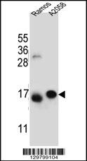 EIF5AL1 Antibody (C-term) (Cat. #AP11986b) western blot analysis in Ramos,A2058 cell line lysates (35ug/lane).This demonstrates the EIF5AL1 antibody detected the EIF5AL1 protein (arrow).