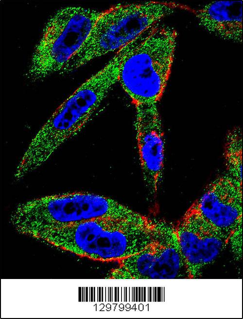 Confocal immunofluorescent analysis of EIF5AL1 Antibody (C-term)(Cat#AP11986b) with A2058 cell followed by Alexa Fluor 488-conjugated goat anti-rabbit lgG (green). Actin filaments have been labeled with Alexa Fluor 555 phalloidin (red).DAPI was used to stain the cell nuclear (blue).