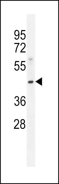 MOGT3 Antibody (C-term) (Cat. #AP11954b) western blot analysis in Jurkat cell line lysates (35ug/lane).This demonstrates the MOGT3 antibody detected the MOGT3 protein (arrow).