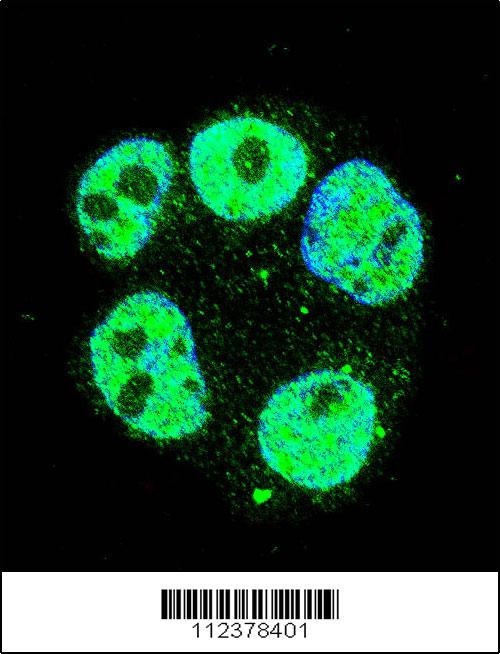 Confocal immunofluorescent analysis of METTL2 Antibody (C-term)(Cat#AP11952b) with ZR-75-1 cell followed by Alexa Fluor 488-conjugated goat anti-rabbit lgG (green). DAPI was used to stain the cell nuclear (blue).