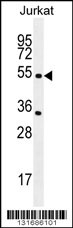 CHRNA2 Antibody (N-term) (Cat. #AP11942a) western blot analysis in Jurkat cell line lysates (35ug/lane).This demonstrates the CHRNA2 antibody detected the CHRNA2 protein (arrow).