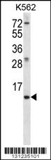 MEIG1 Antibody (Center) (Cat. #AP12447c) western blot analysis in K562 cell line lysates (35ug/lane).This demonstrates the MEIG1 antibody detected the MEIG1 protein (arrow).