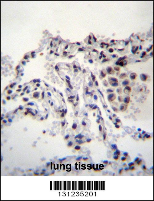 MEIG1 Antibody (Center) (Cat. #AP12447c)immunohistochemistry analysis in formalin fixed and paraffin embedded human lung tissue followed by peroxidase conjugation of the secondary antibody and DAB staining.This data demonstrates the use of MEIG1 Antibody (Center) for immunohistochemistry. Clinical relevance has not been evaluated.