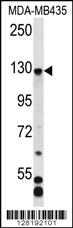 C7orf63 Antibody (N-term) (Cat. #AP12429a) western blot analysis in MDA-MB435 cell line lysates (35ug/lane).This demonstrates the C7orf63 antibody detected the C7orf63 protein (arrow).
