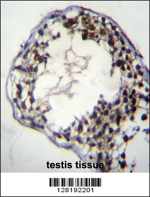C7orf63 Antibody (N-term) (Cat. #AP12429a)immunohistochemistry analysis in formalin fixed and paraffin embedded human testis tissue followed by peroxidase conjugation of the secondary antibody and DAB staining.This data demonstrates the use of C7orf63 Antibody (N-term) for immunohistochemistry. Clinical relevance has not been evaluated.