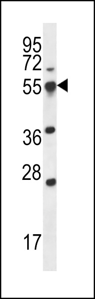 SMAP2 Antibody (Center) (Cat. #AP12427c) western blot analysis in 293 cell line lysates (35ug/lane).This demonstrates the SMAP2 antibody detected the SMAP2 protein (arrow).