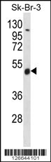 WDR34 Antibody (Center) (Cat. #AP12421c) western blot analysis in SK-BR-3 cell line lysates (35ug/lane).This demonstrates the WDR34 antibody detected the WDR34 protein (arrow).