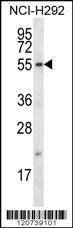 FBXO15 Antibody (N-term) (Cat. #AP12418a) western blot analysis in NCI-H292 cell line lysates (35ug/lane).This demonstrates the FBXO15 antibody detected the FBXO15 protein (arrow).