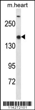 SET1B Antibody (C-term) (Cat. #AP12413b) western blot analysis in mouse heart tissue lysates (35ug/lane).This demonstrates the SET1B antibody detected the SET1B protein (arrow).