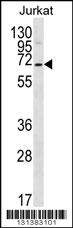 PSAPL1 Antibody (N-term) (Cat. #AP12400a) western blot analysis in Jurkat cell line lysates (35ug/lane).This demonstrates the PSAPL1 antibody detected the PSAPL1 protein (arrow).