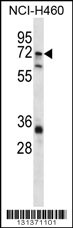 ST6GALNAC1 Antibody (N-term) (Cat. #AP12398a) western blot analysis in NCI-H460 cell line lysates (35ug/lane).This demonstrates the ST6GALNAC1 antibody detected the ST6GALNAC1 protein (arrow).