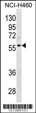 CCNL2 Antibody (Center) (Cat. #AP12396c) western blot analysis in NCI-H460 cell line lysates (35ug/lane).This demonstrates the CCNL2 antibody detected the CCNL2 protein (arrow).
