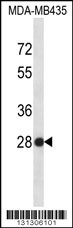 SNRPB2 Antibody (N-term) (Cat. #AP12381a) western blot analysis in MDA-MB435 cell line lysates (35ug/lane).This demonstrates the SNRPB2 antibody detected the SNRPB2 protein (arrow).