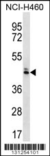 OR52N5 Antibody (C-term) (Cat. #AP12368b) western blot analysis in NCI-H460 cell line lysates (35ug/lane).This demonstrates the OR52N5 antibody detected the OR52N5 protein (arrow).